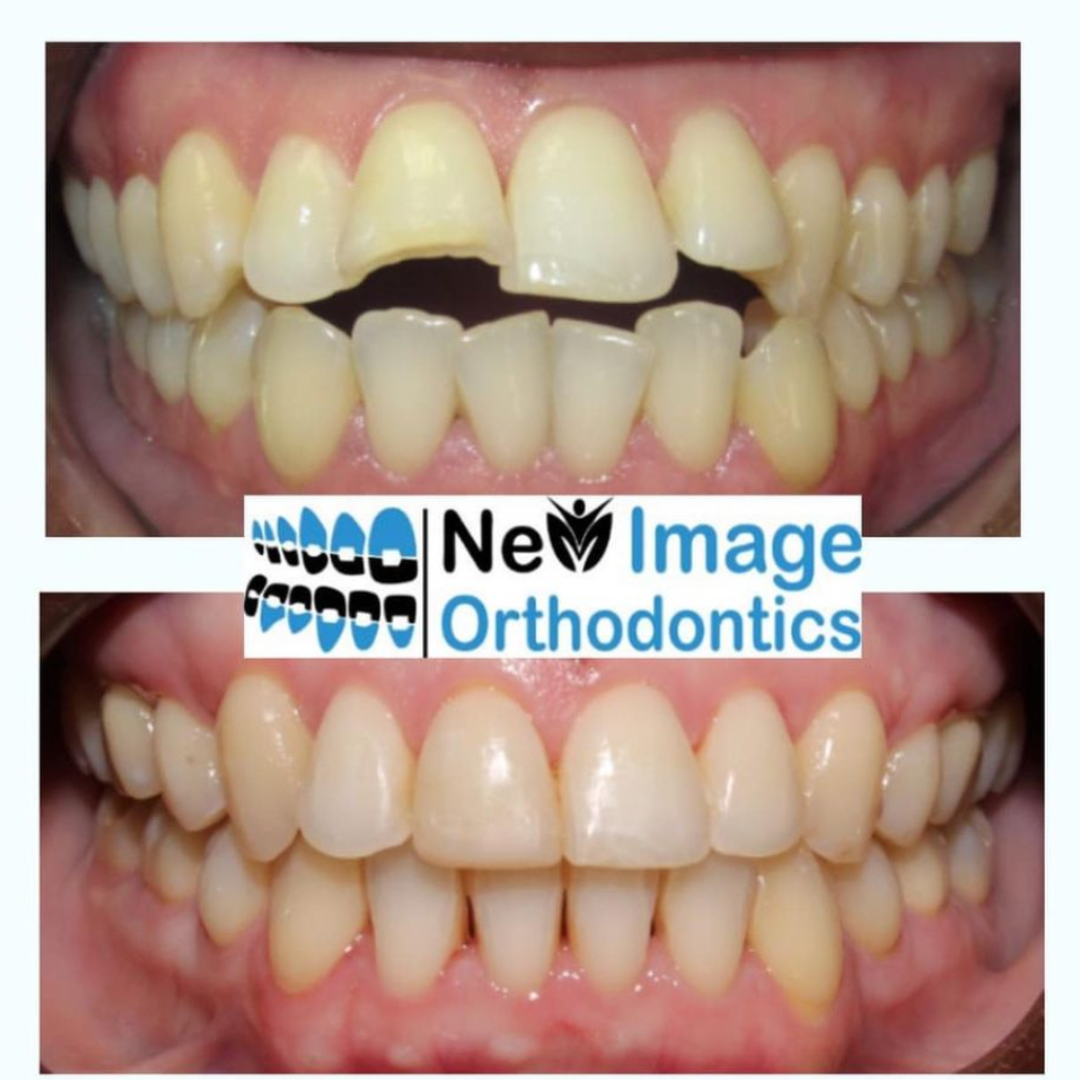 11 new image orthodontics